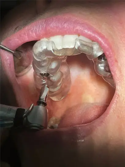 Clínica Dental Implantsite | Odontología Avanzada | Dos Hermanas