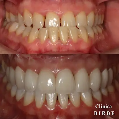 Clínica Birbe - Cirugía Maxilofacial, Estética Oral y Facial