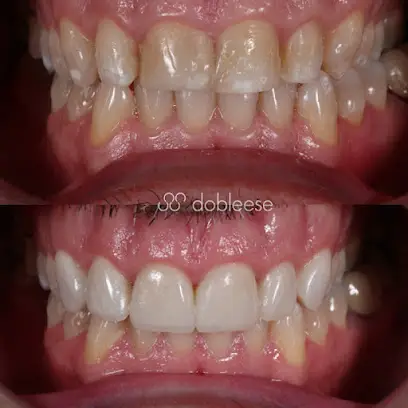 Dobleese Clínica Dental en Sevilla | Implantes Dentales, Carillas Dentales, Periodoncia y Estética Dental